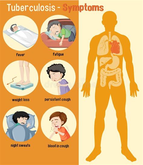 Tuberculosis Symptoms And Prevention Information Poster With Text And