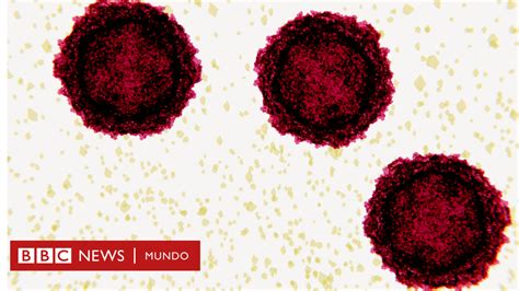 Qué Es Y Cómo Se Propaga La Polio La Enfermedad Casi Erradicada De La Que Se Detectó El Primer