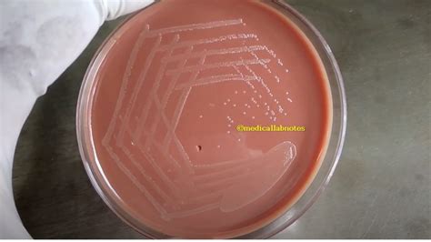 Chocolate Agar: Introduction, Composition, Principle, Preparation