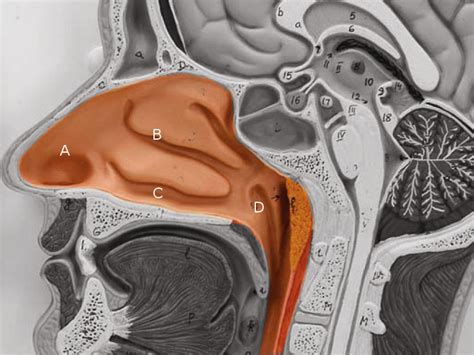 Figure Opening Of The Nasolacrimal Duct Image Courtesy S Bhimji Md