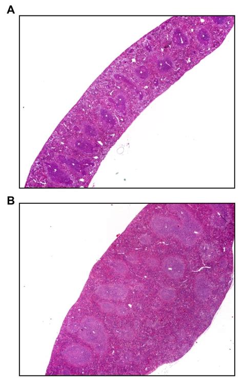 Hyperplasia histology analysis of the spleen in a transgenic mouse ...