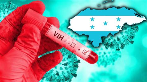 Honduras Promedia Entre A Infecciones De Vih Por A O