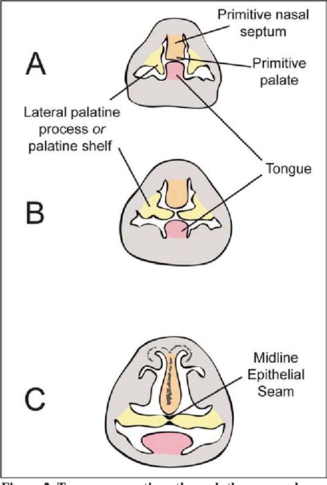 Figure 1 from Palatoschisis in the dog: developmental mechanisms and etiology | Semantic Scholar