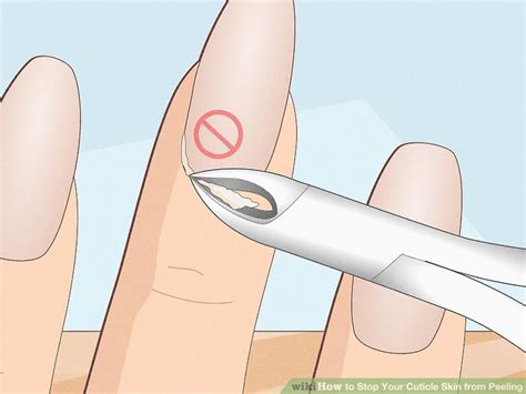 How To Stop Your Cuticle Skin From Peeling With Pictures