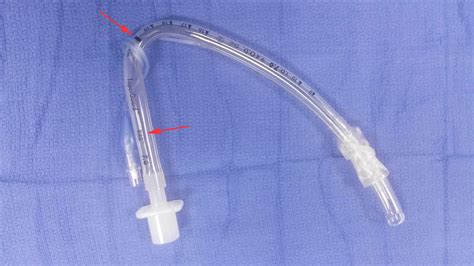 Intubation Definition Endotracheal Intubation Nasal Intubation