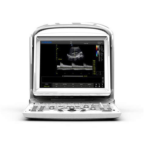 Ecógrafo veterinario portátil ECO 3 EXPERT Chison Medical Imaging