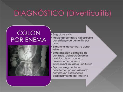 Ppt Enfermedad Diverticular Powerpoint Presentation Id 4011364