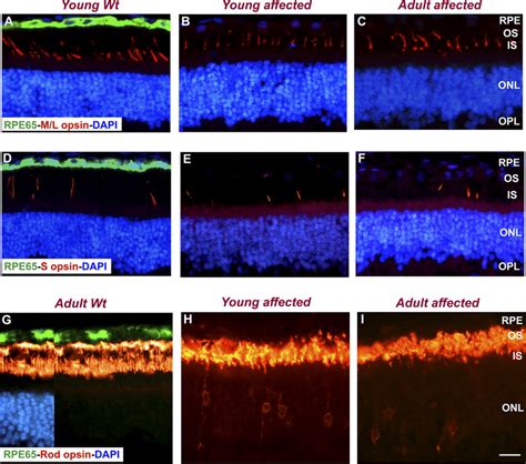 Immunohistochemical Localization Of RPE65 M L And S Cone Opsins And