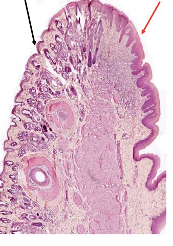 Histology Of Oral Cavity Salivary Glands This One Flashcards Quizlet