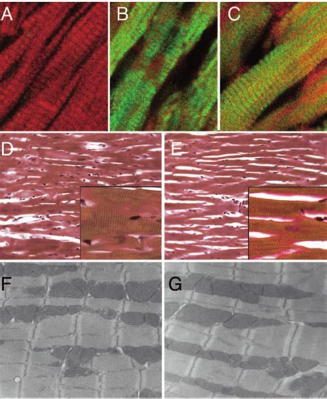 Transgenic Expression Of Mhc In The Heart A Diagram Of The Tg