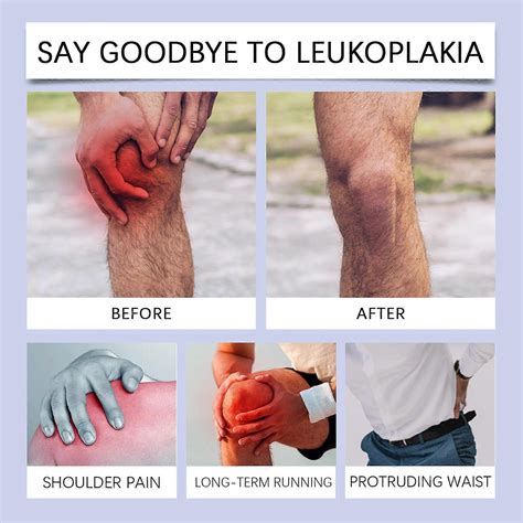 Joint Care Cream, Joint Cream for Soothing Relief of Joint Pain, Muscle