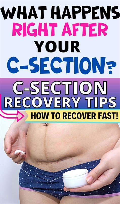 What Happens After Your C Section Artofit