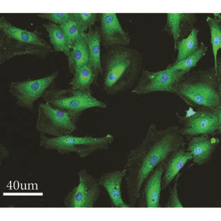 The identification of rat retinal Müller cells a The morphology of