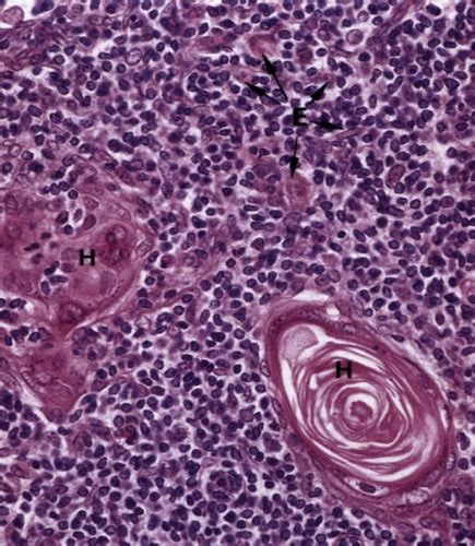 Histology 4 Lymphoid Tissues Flashcards Quizlet