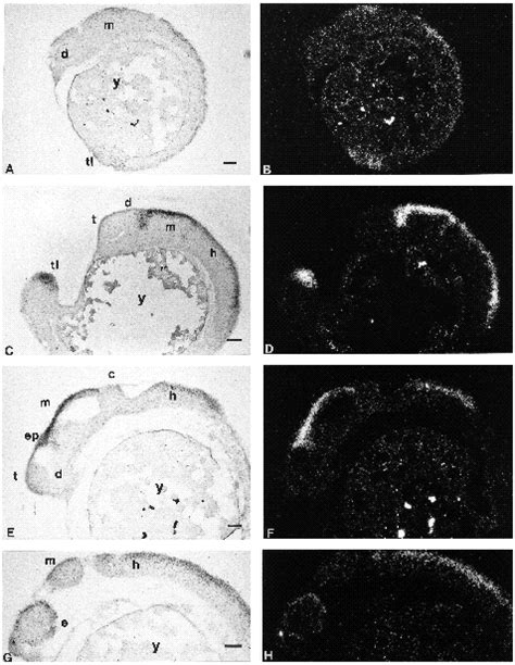 Localization Of Wnt A Transcripts By In Situ Hybridization On Tissue