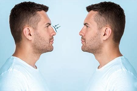 Plastic Surgery For Men Trends Procedures And Outcomes