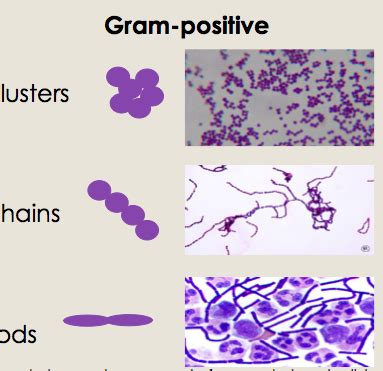 Microbiology Objective Flashcards Quizlet