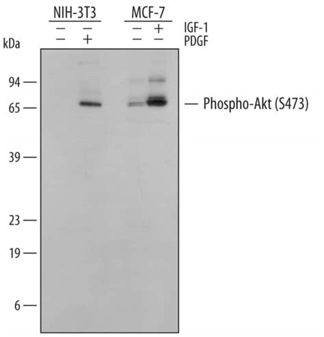 Phospho Akt S473 Pan Specific Rabbit Anti Human Mouse Rat