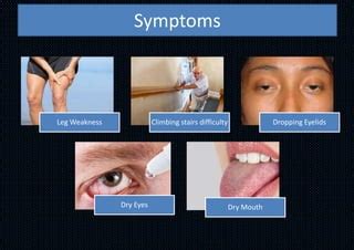 Lambert–Eaton myasthenic syndrome ( lems) | PPT