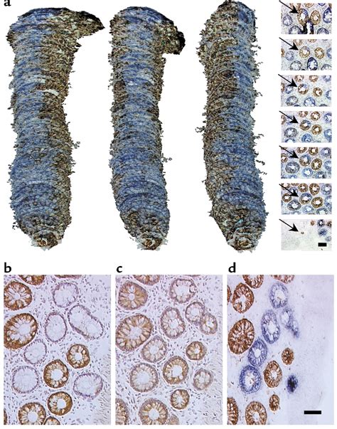 Figure From Mitochondrial Dna Mutations In Human Colonic Crypt Stem