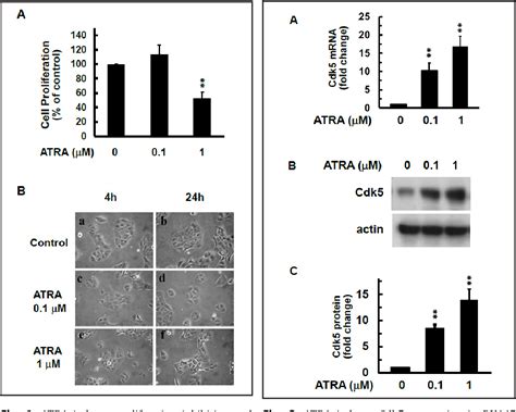 Figure 1 From All Trans Retinoic Acid Induces Du145 Cell Cycle Arrest