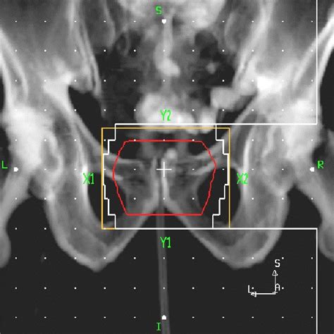 A Photo Of Philips Brilliance Big Bore Ct Scanner Philips Medical Download Scientific Diagram