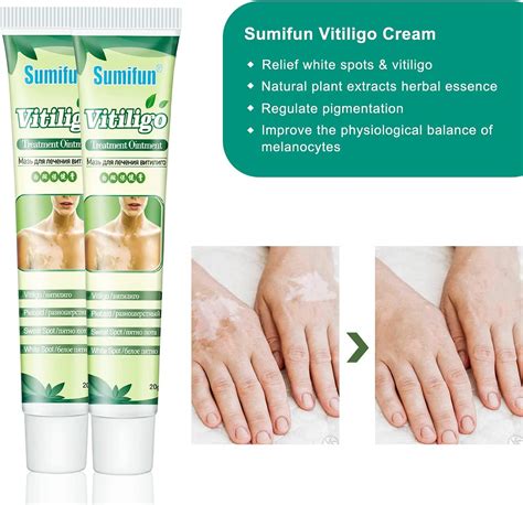 Sumifun Vitiligo Cream Skin Care For Vitiligo Psoriasis