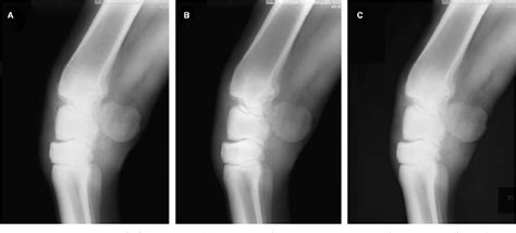 Figure 1 From Digital Radiography Artifacts Semantic Scholar