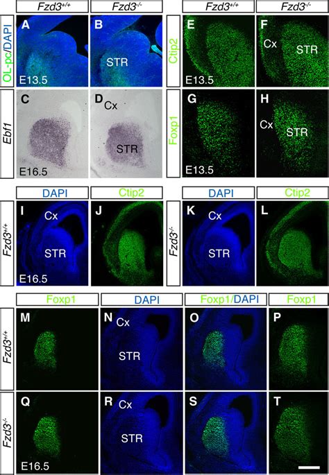 Msn Differentiation Is Intact In Frizzled Mice Immunocytochemistry