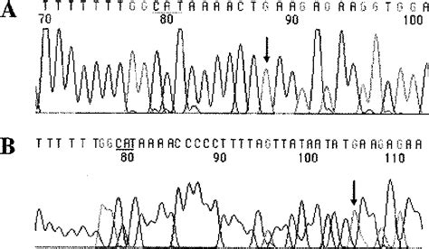 Figure 1 From Optimized Rapid Amplification Of CDNA Ends RACE For