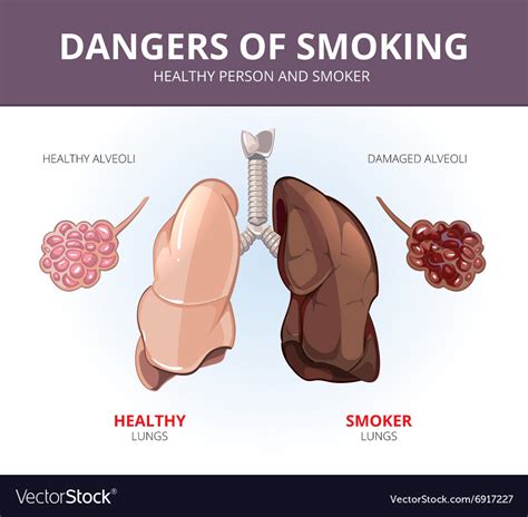 Lungs And Alveoli Of A Healthy Person Smoker Vector Image