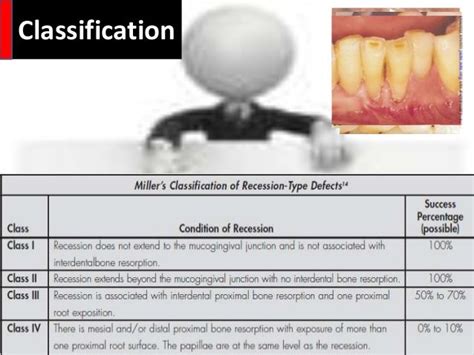 Gingival Recession