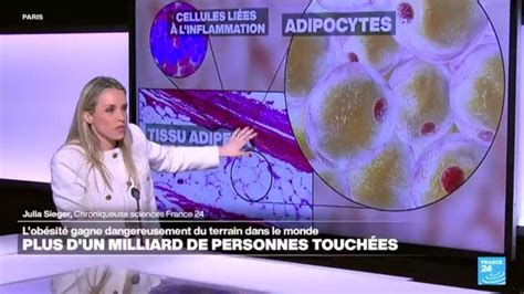 Obésité un milliard de personnes concernées dans le monde Sciences