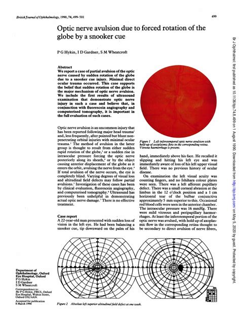 Optic Nerve Avulsion Due To Forced Rotation of The Globe by A Snooker Cue. | PDF | Retina | Eye