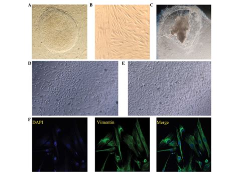 Co‑culture With Endometrial Stromal Cells Enhances The Differentiation