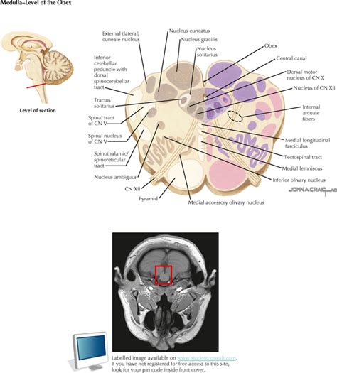 Brain Stem Anatomy Cross Section