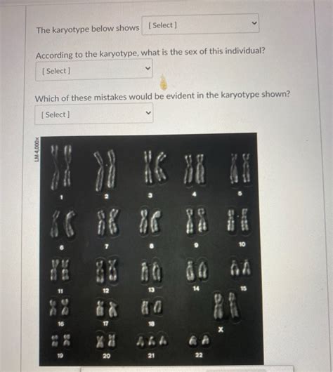 Solved The Karyotype Below Shows Select According To The Chegg