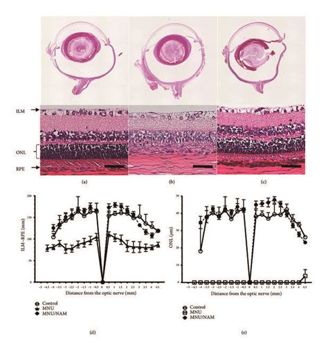 Histological Retinal Examination Seven Days After MNU Or MNU NAM