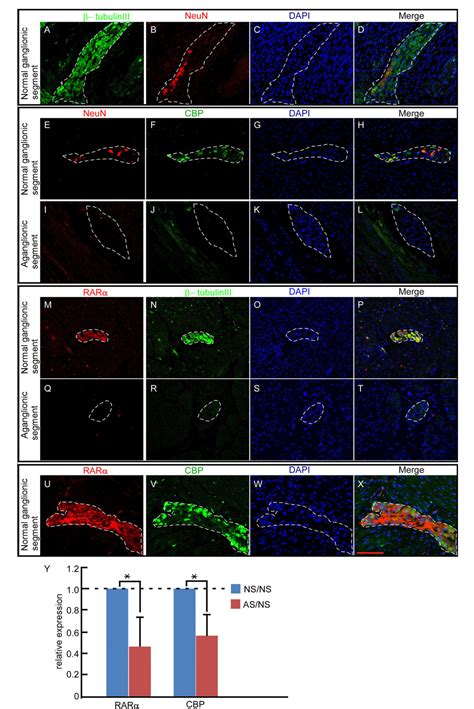 Figure 1 From Alteration Of The Retinoid Acid Cbp Signaling Pathway In