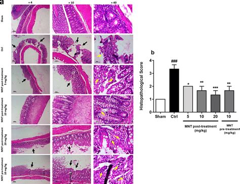 Hematoxylin And Eosin Stained Sections Of Rat Colons From Healthy