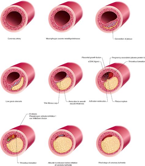 Figure From Vascular Health And Risk Management Dovepress Emerging