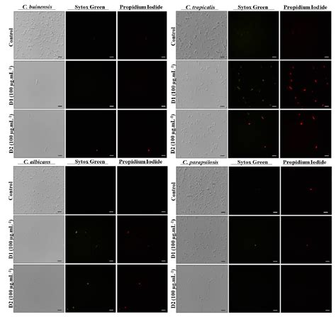 Scielo Brazil Characterization And Antimicrobial Activity Of Protease