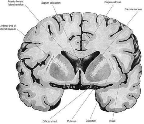 Basal Ganglia Coronal Section