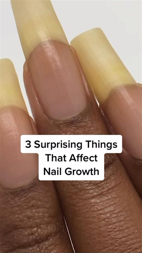 3 Surprising Things That Affect Nail Growth Nail Growth Cure Nails