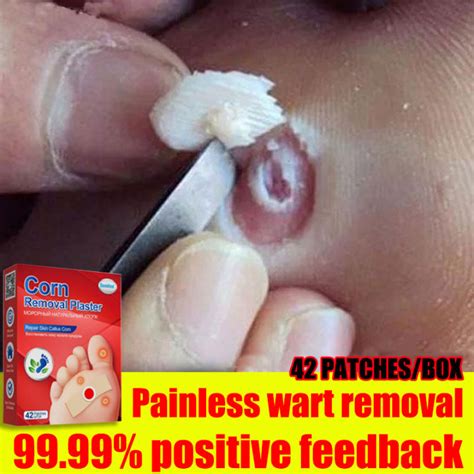 SUMIFUN Warts Remover Patch 42 Box Remove Calluses On Hands And Feet