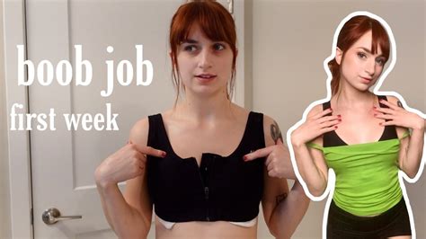 Boob Job Vlog Surgery 1 Week Youtube