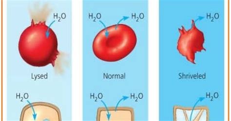 BIOLOGI GONZAGA OSMOSIS KRENASI PLASMOLISIS