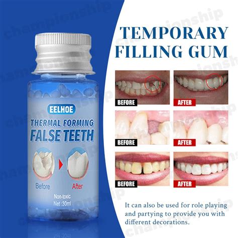 Temporary Tooth Repair Kit Teeth And Gaps Falseteeth Solid Glue Denture