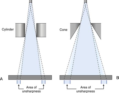 Beam Restricting Devices The Best Picture Of Beam