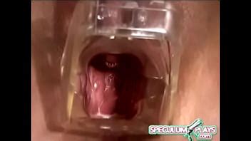 Espéculo XVIDEOS